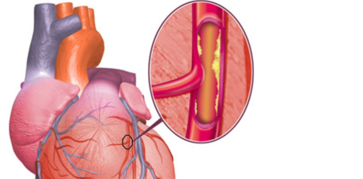 Servicios del Instituto de Salud Cardiovascular